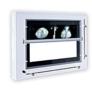 Zdjęcie Negatoskop żaluzjowy do mammografii NGP-31 mZU