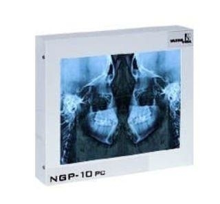 Zdjęcie Negatoskop CEFALOM 01