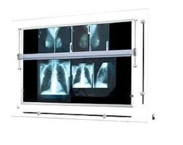 Zdjęcie Negatoskop żaluzjowy do mammografii NGP-41 mZU